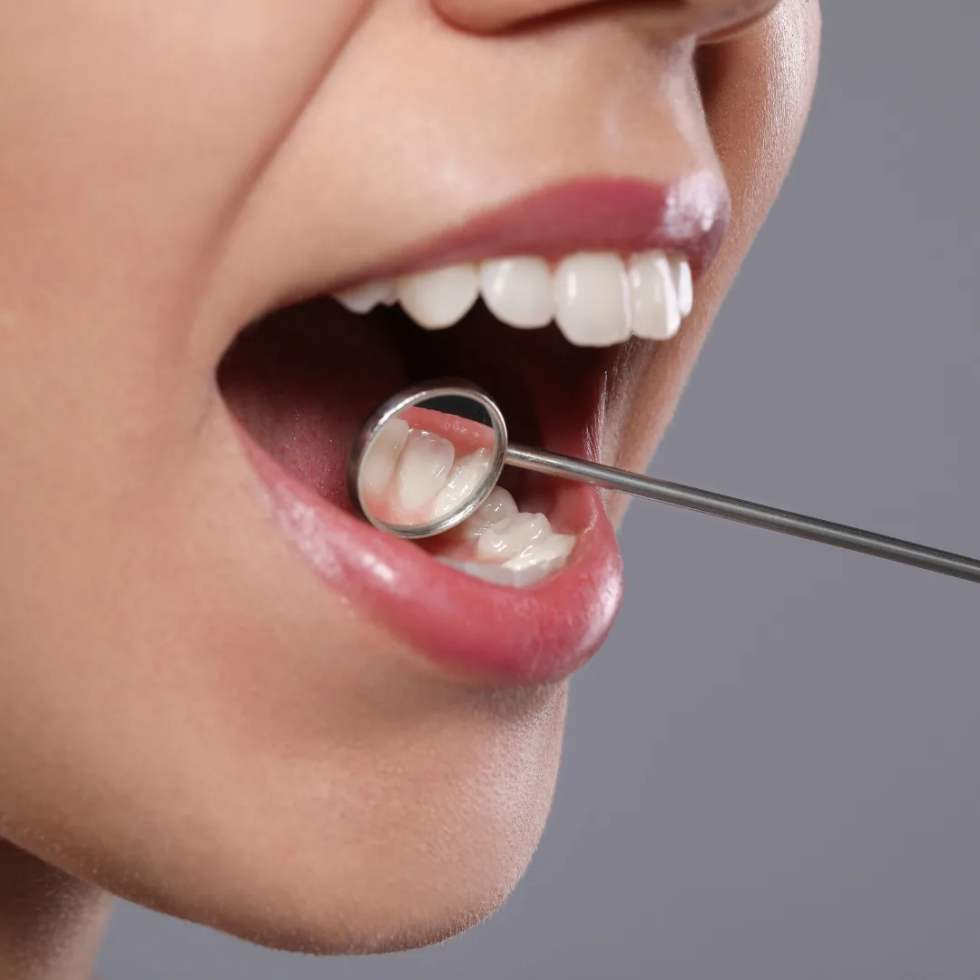 Oral Cancer Screenings